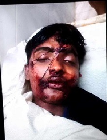 চাঁদপুর ফরিদগঞ্জে সিএনজি'র সঙ্গে সংঘর্ষে নিহত ২