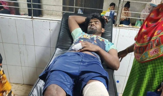 গজারিয়ায় মসজিদের হিসাব চাওয়াকে কেন্দ্র করে যুবককে কুপিয়ে জখমসহ আহত ৭