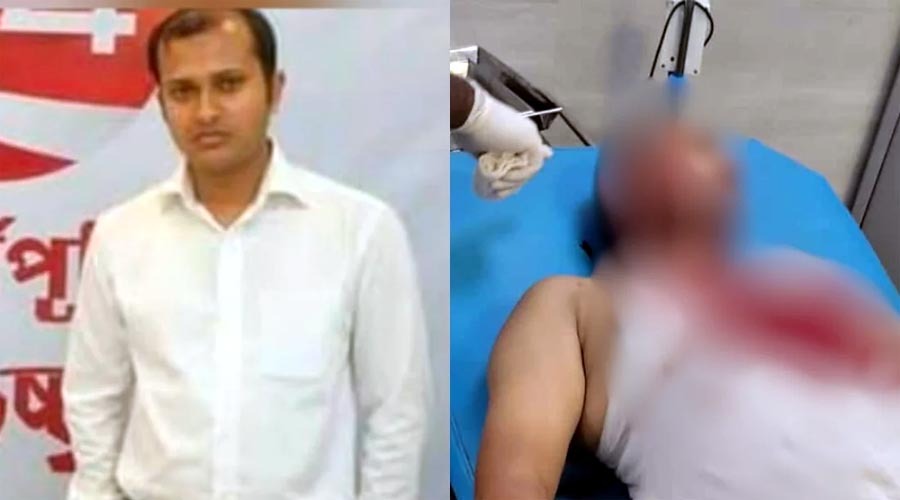 চট্টগ্রামে আ. লীগের ঝটিকা মিছিল, পুলিশের এসআই’কে কুপিয়ে জখম