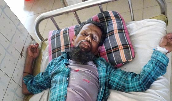 বাউফল মধ্যেযুগীয় কায়দায় আপন ভাইেকে নির্যাতনের অভিযোগ