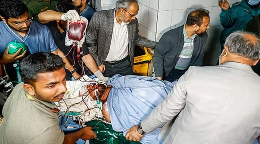 মাথার এক পাশ দিয়ে গুলি ঢুকে আরেক পাশ দিয়ে বের হয় হাদির, অবস্থা সংকটাপন্ন