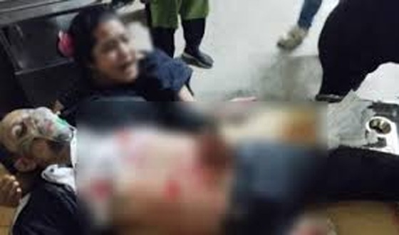 বরিশালে যুবলীগ নেতাকে কুপিয়ে জখম