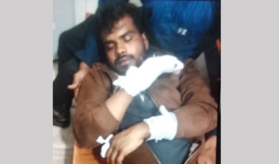 বাউফলে বিএনপির দুই গ্রুপের সংঘর্ষে হাতের আঙ্গুল বিচ্ছিন্ন