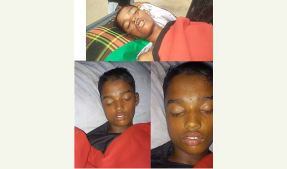 গাইবান্ধায় ১৭ দিন ধরে অচেতন অজ্ঞাত কিশোর
