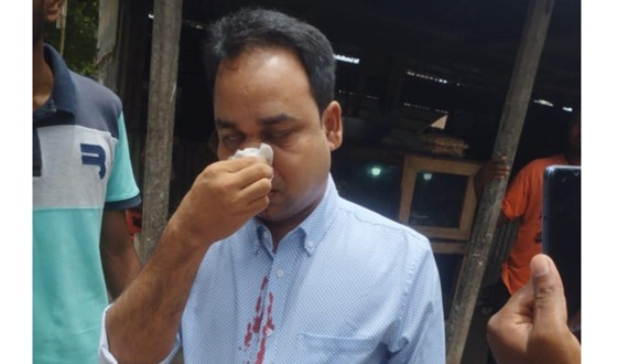 রাজারহাট স্বাস্থ্য কমপ্লেক্সে সন্ত্রাসী হামলার শিকার ফার্মাসিস্ট মামুন