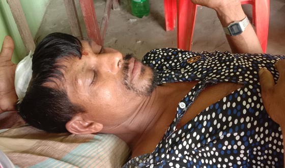 কয়রায় পুর্বের শত্রুতার জের ধরে যুবককে মাথা ফাটালো