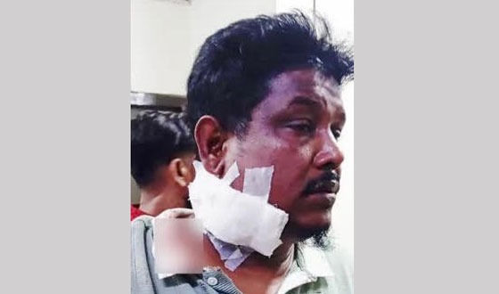 চট্টগ্রামে বিএনপির দুই গ্রুপের গোলাগুলি, থানার ওসিকে প্রত্যাহার