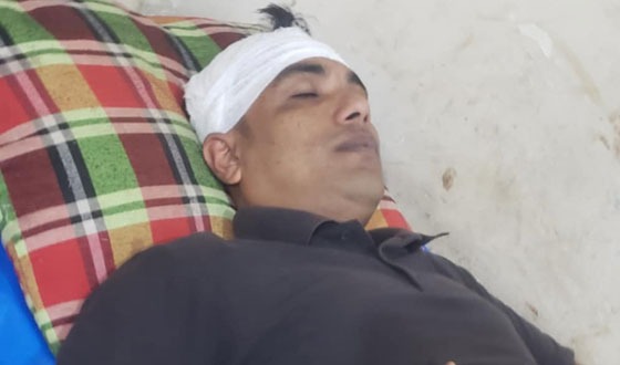 ইমাম নিয়ে বিরোধ : যুবদল কর্মী রক্তাক্ত জখম