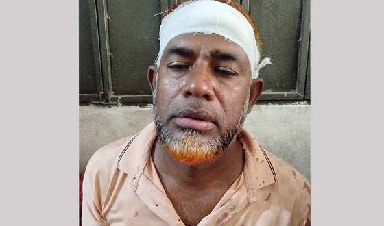 বরিশালে বিএনপি নেতাকে কুপিয়ে জখম
