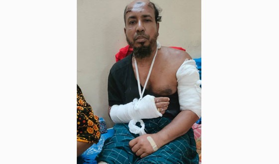সড়ক দুর্ঘটনায় আহত শিক্ষক সকলের সহযোগিতা চায়