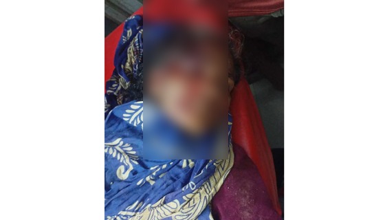 কলমাকান্দায় অটোর নিচে পড়ে প্রাণ হারালেন নারী