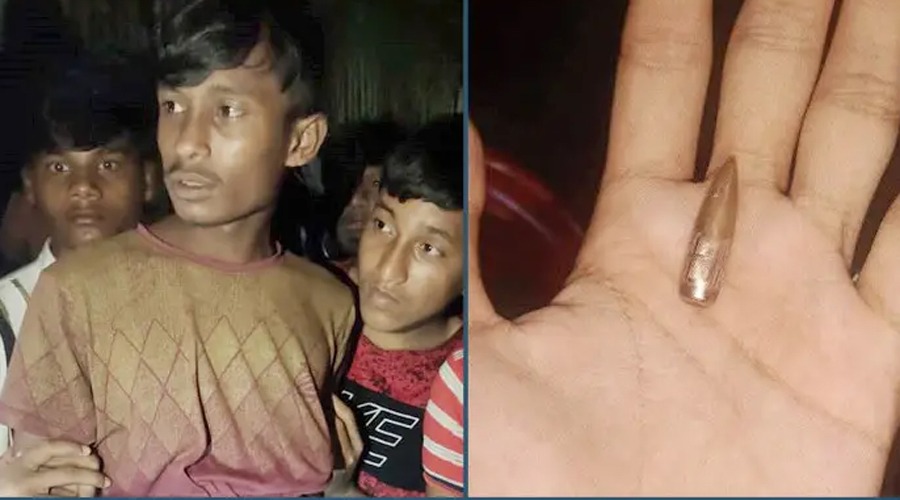 সীমান্তের ওপারে প্রচণ্ড গোলাগুলি, এপারে রোহিঙ্গা যুবক গুলিবিদ্ধ