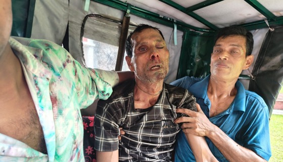 ইন্দুরকানীতে ভাতিজার দায়ের কোপে চাচা আহত