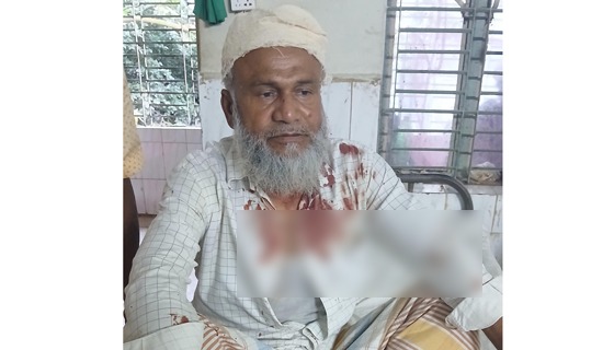 চাটমোহরে প্রতিপক্ষের হামলায় আহত ২