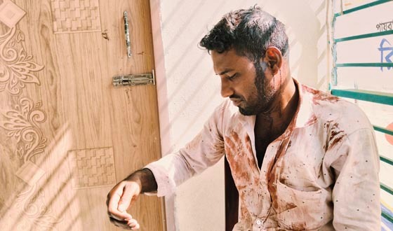 কলাপাড়ায় সমুদ্রে জেলে ট্রলারে হামলা, আহত ২
