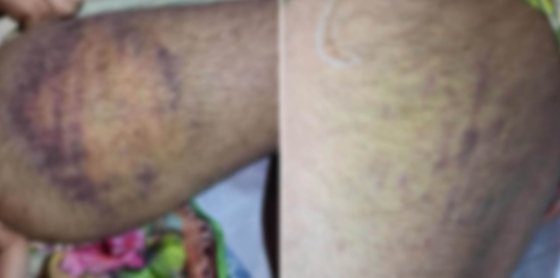 রাজশাহীতে মাদ্রাসার টর্চার কক্ষে শিক্ষার্থীকে নির্যাতন, থানায় অভিযোগ