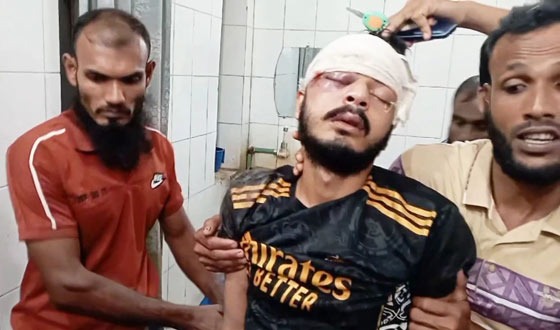 বাউফলে দুই ভাইয়ের বিরোধে একজনের মাথা থেতলে দেওয়ার অভিযোগ