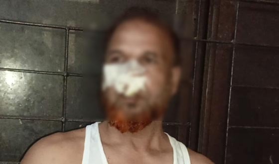 বাজিতপুর হাটে চোর সন্দেহে এক ব্যক্তিকে গণধোলাই