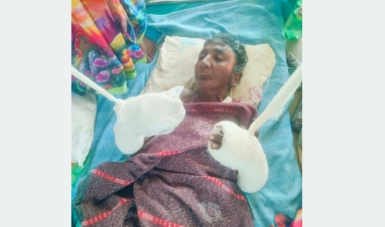 বাগমারায় বিধবা সাবিত্রী বালার শেষ সম্বল আগুনে পুড়ে ছাই