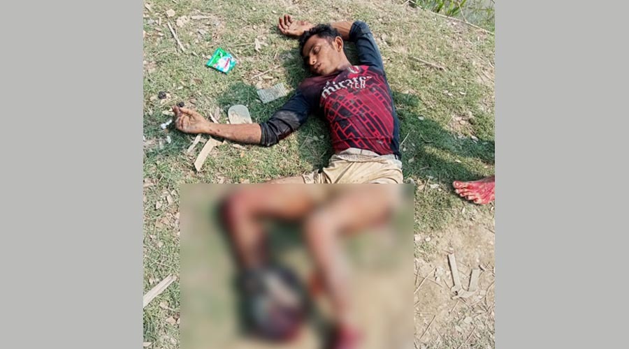 উখিয়া সীমান্তে ফের মাইন বিস্ফোরণ, ৫ দিনে পা হারালেন দুই রোহিঙ্গা যুবক