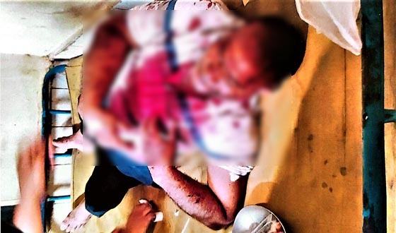 টাঙ্গাইলে এমপি গ্রুপের হামলায় বিএনপির চার নেতাকর্মী আহত