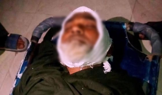 কোটচাঁদপুরের সড়ক দুর্ঘটনায় একজনের মৃত্যু