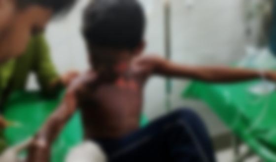 হাই বোল্টেজর খুঁটিতে উঠে বিদ্যুতায়িত হয়ে শিশু আহত