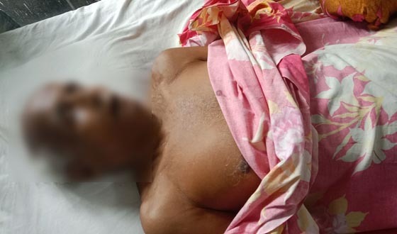 ছোট ভাইয়ের ধাক্কায় বড় ভাইয়ের মৃত্যু