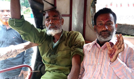 চাটমোহরে সড়ক দূর্ঘটনায় আহত ৩