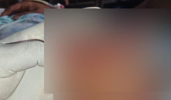 বাবুগঞ্জে জমি-সংক্রান্ত বিরোধে হামলা, নারীসহ আহত ৪