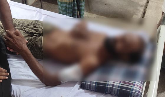 দেবহাটায় ডাকাতিতে বাধা দেওয়ায় কুপিয়ে জখম, অভিযোগ দায়ের