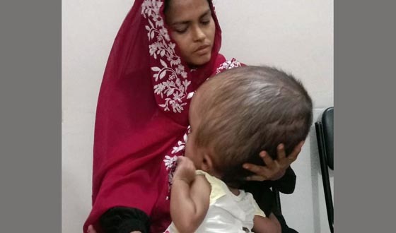 দুই বছরের শিশুর মাথার ওজন ১২ কেজি