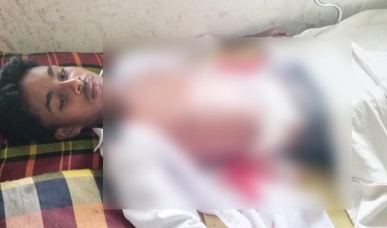 হোসেনপুরে কিশোর গ্যাংয়ের ছুরিকাঘাতে স্কুলছাত্র আহত