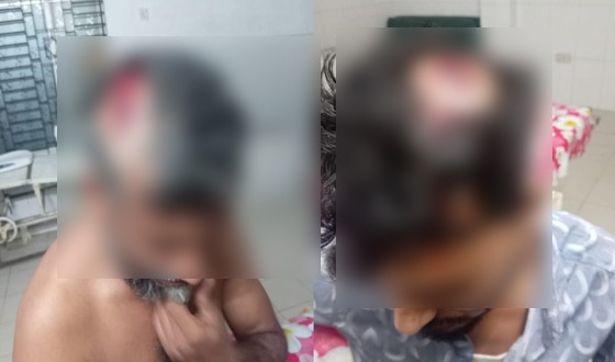 সলঙ্গায় জমির গাছ কাটা নিয়ে সংঘর্ষে আহত ৭ জন