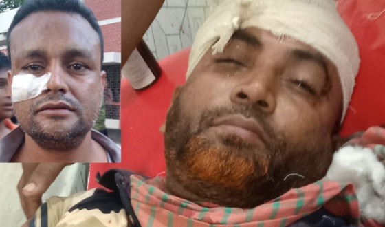 বাঘায় জমি নিয়ে মারামারিতে দুই পক্ষের আহত ১০