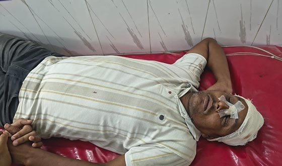বরিশালে কৃষক দল নেতার ওপর সশস্ত্র হামলা