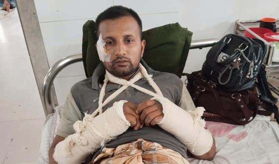 বরিশালে মোটরসাইকেল দূর্ঘটনায় সাংবাদিক গুরুত্বর আহত