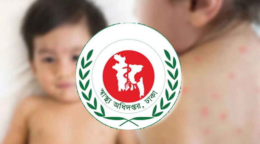 হামের উপসর্গে ঢাকাতেই আরও ৬ শিশুর মৃত্যু