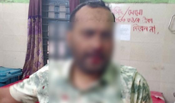 কালীগঞ্জ স্বাস্থ্য কমপ্লেক্সে হামলায় মেডিকেল টেকনোলজিস্ট আহত