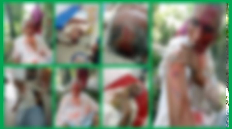চাঁদাবাজির মামলায় জামিনে বের হয়ে বাদীসহ তিনজনকে কুপিয়ে জখম