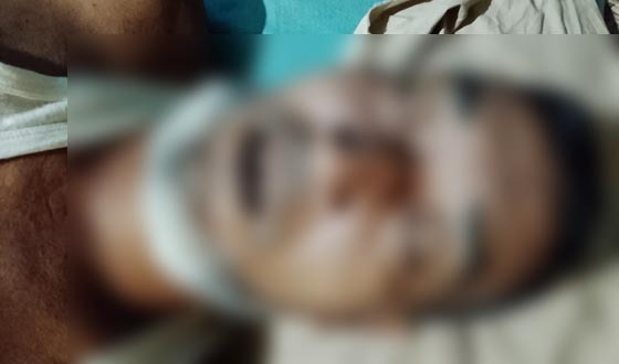 সাতকানিয়ায় জায়গা পরিমাপের সময় এক ব্যাক্তির মৃত্যু