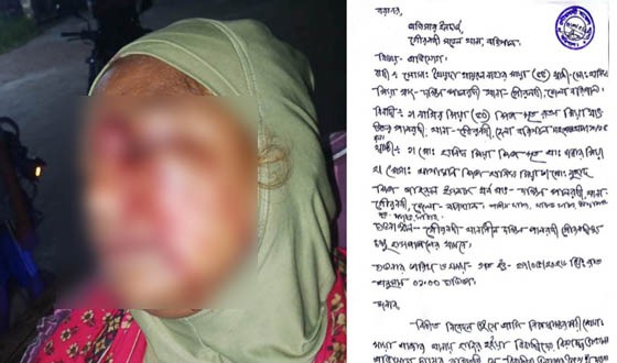 সাবেক নারী পৌর কাউন্সিলরকে পিটিয়ে রক্তাক্ত জখম