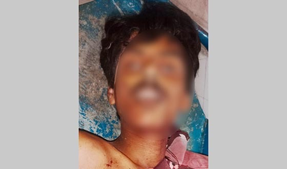 খুলনায় যুবককে ধারালো অস্ত্র দিয়ে কুপিয়ে হত্যা