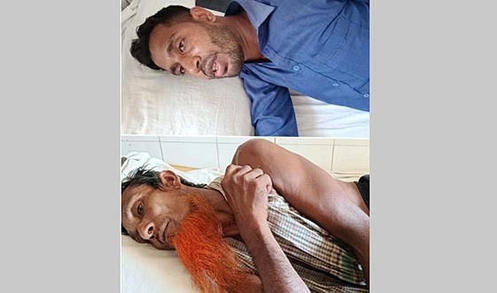 আগৈলঝাড়ায় মাদকসেবনে বাধাদেওয়াতে হামলায় পিতা-পুত্র আহত