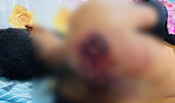 সাতক্ষীরায় বিএসএফের গুলিতে দুই বাংলাদেশি আহত