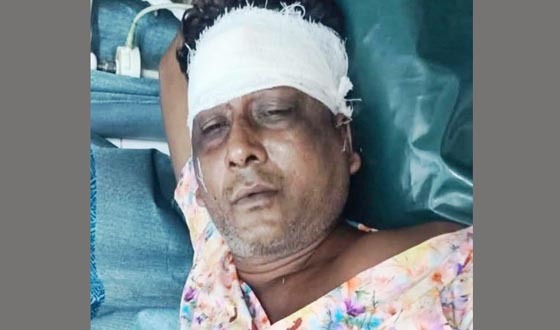 খুলনার রূপসায় বিএনপি নেতা গুলিবিদ্ধ