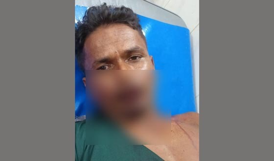 পাইকগাছায় স্বামী-স্ত্রীকে হাতুড়ি পিটা