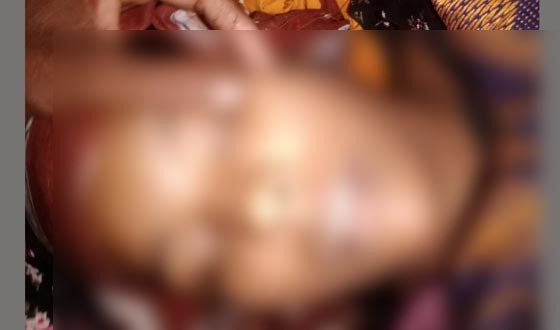 পাটকেলঘাটায় গৃহবধূকে পিটিয়ে ও শ্বাসরোধে হত্যার অভিযোগ