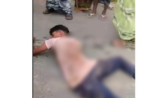 রাজশাহীতে ইটবোঝাই ট্রলির ধাক্কায় শিশুর হাত-পা বিচ্ছিন্ন