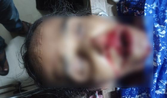 মোল্লাহাটে ধলেশ্বর পরিবহনের চাপায় নারী নিহত